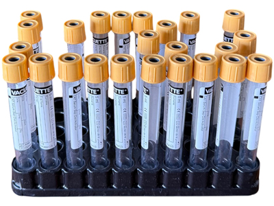 Forensic Hospital Sample Test Tube Tray Props, Prop Hire